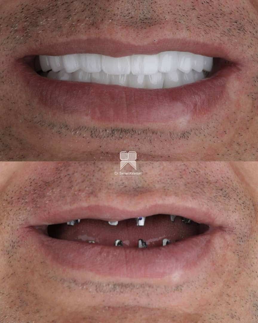 1d43b4a6-84f2-4421-b188-0729c36c7e99 1d43b4a6-84f2-4421-b188-0729c36c7e99