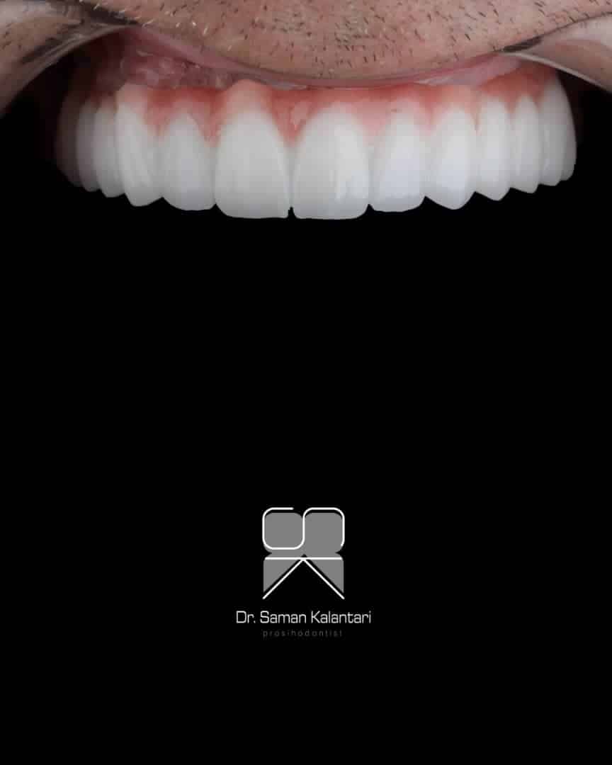 217ddc1f-a253-4404-83f9-e1799510e9cf 217ddc1f-a253-4404-83f9-e1799510e9cf