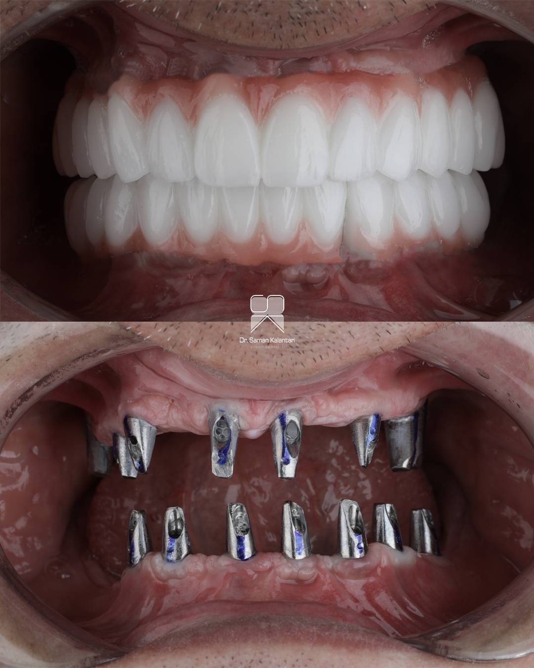 c9f24999-2720-4bc7-b13b-3b730c0514ab c9f24999-2720-4bc7-b13b-3b730c0514ab